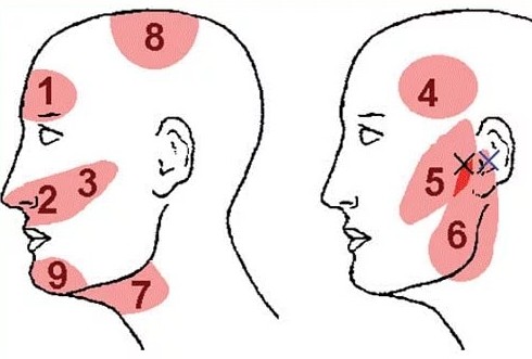 сильно болит голова отдает в висок