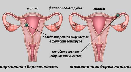 разновидности классификация